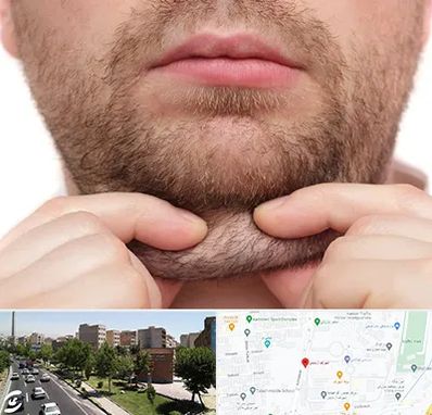 ساکشن غبغب در شهرک آزمایش 