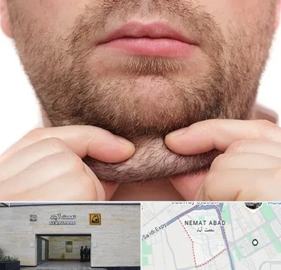 ساکشن غبغب در نعمت آباد