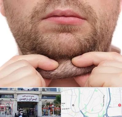 ساکشن غبغب در ایران زمین