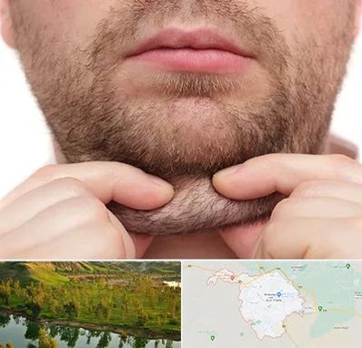 ساکشن غبغب در بهبهان