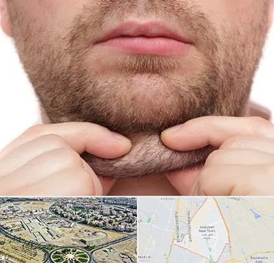 ساکشن غبغب در اندیشه