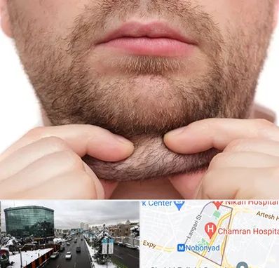 ساکشن غبغب در اقدسیه 