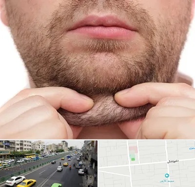 ساکشن غبغب در خیابان دامپزشکی