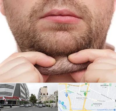 ساکشن غبغب در بلوار فردوس 