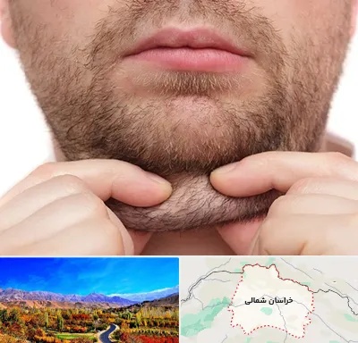 ساکشن غبغب در خراسان شمالی