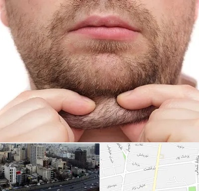 ساکشن غبغب در زرتشت