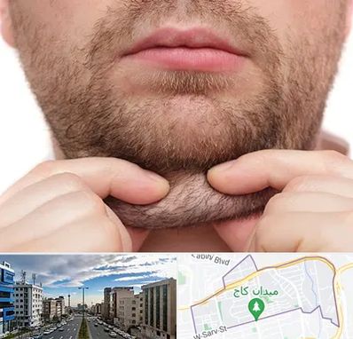 ساکشن غبغب در سعادت آباد 