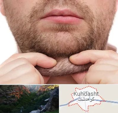 ساکشن غبغب در کوهدشت