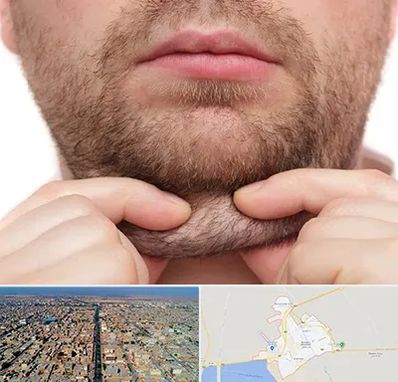 ساکشن غبغب در بندر ماهشهر