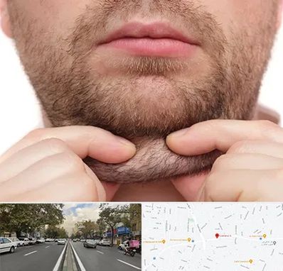 ساکشن غبغب در دولت 