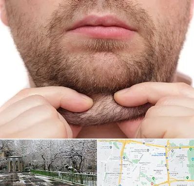 ساکشن غبغب در باغ فیض 