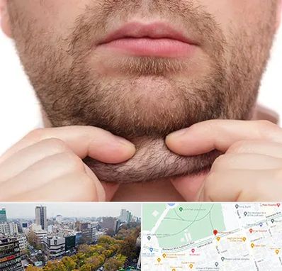 ساکشن غبغب در بلوار کشاورز 