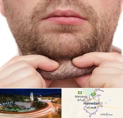 ساکشن غبغب در همدان