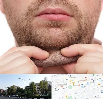 ساکشن غبغب در میدان کاج 