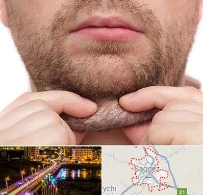 ساکشن غبغب در سقز