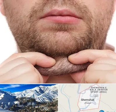 ساکشن غبغب در شمشک
