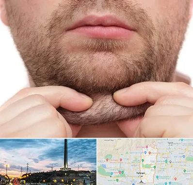 ساکشن غبغب در منطقه 2 تهران 