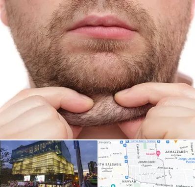 ساکشن غبغب در جمهوری 