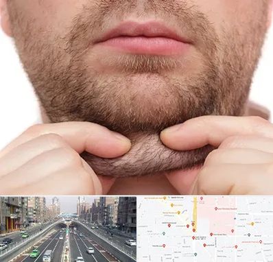 ساکشن غبغب در توحید 