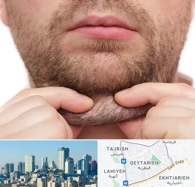 ساکشن غبغب در قیطریه 