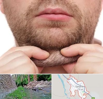 ساکشن غبغب در سراوان