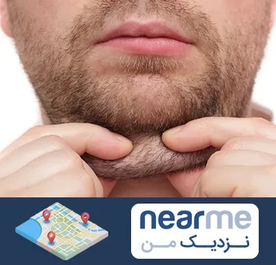 ساکشن غبغب در نزدیک من