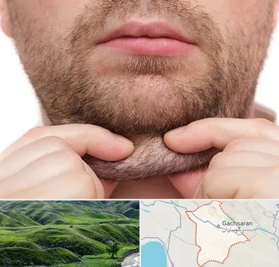 ساکشن غبغب در گچساران