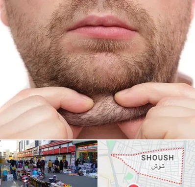 ساکشن غبغب در شوش