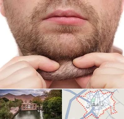 ساکشن غبغب در دامغان