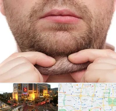 ساکشن غبغب در جنت آباد تهران 