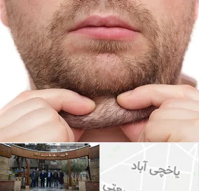 ساکشن غبغب در یاخچی آباد