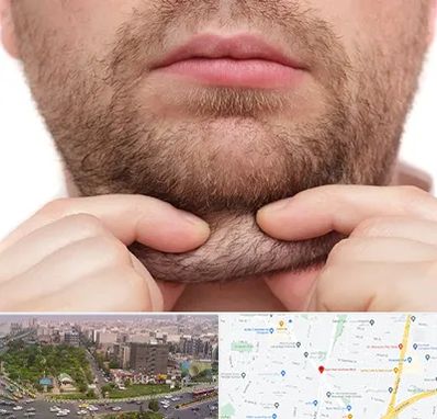 ساکشن غبغب در آیت الله کاشانی 