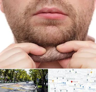 ساکشن غبغب در میرداماد 