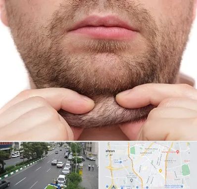 ساکشن غبغب در ستارخان 