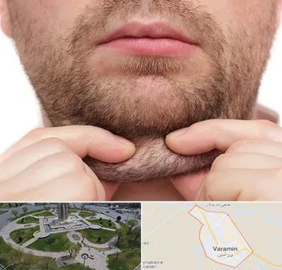 ساکشن غبغب در ورامین