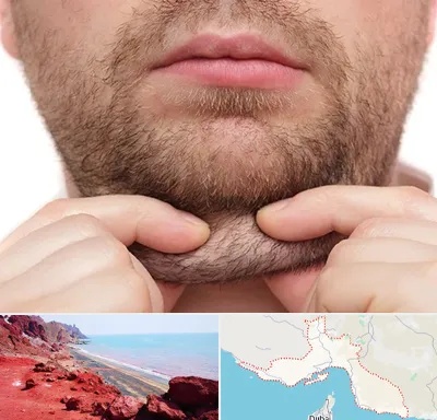 ساکشن غبغب در هرمزگان