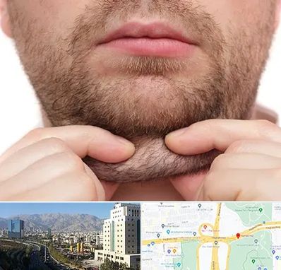 ساکشن غبغب در حقانی 