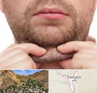 ساکشن غبغب در فشم