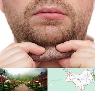ساکشن غبغب در فومن