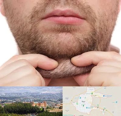 ساکشن غبغب در بیرجند
