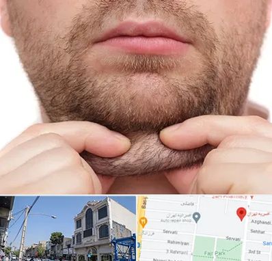 ساکشن غبغب در افسریه 