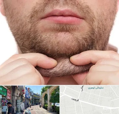 ساکشن غبغب در خیابان قزوین