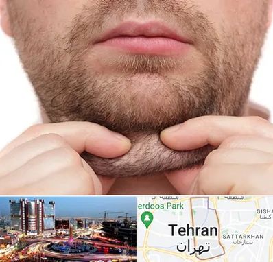 ساکشن غبغب در صادقیه 