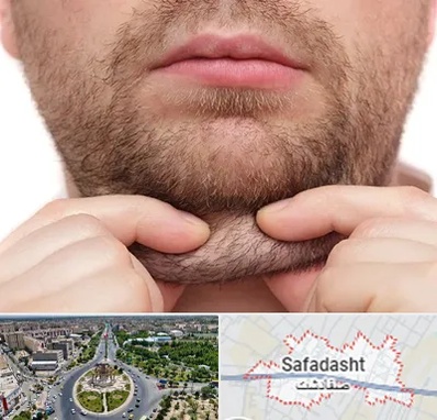 ساکشن غبغب در صفادشت