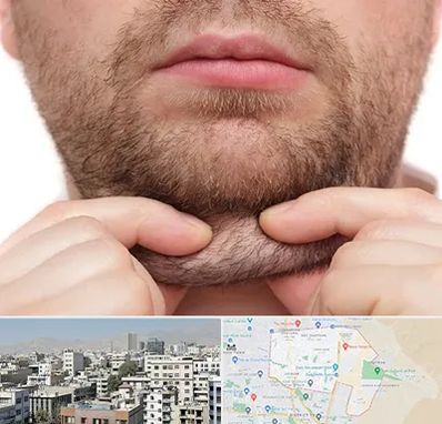 ساکشن غبغب در منطقه 14 تهران