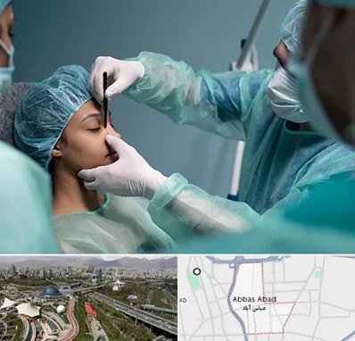 عمل بینی ارزان در عباس آباد تهران