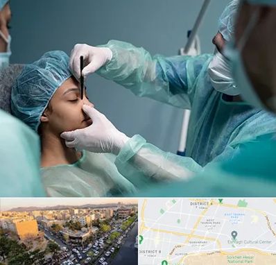 عمل بینی ارزان در تهرانپارس 