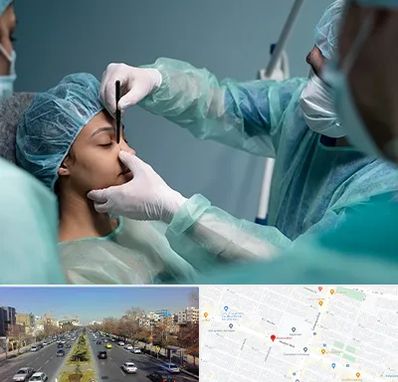 عمل بینی ارزان در بلوار معلم مشهد 