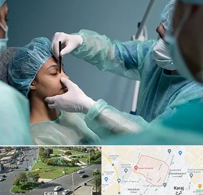 عمل بینی ارزان در شاهین ویلا کرج 