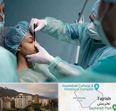 عمل بینی ارزان در زعفرانیه